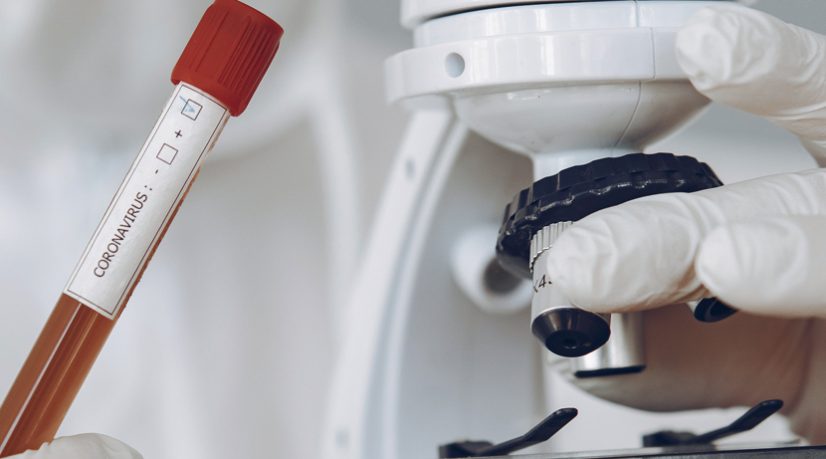 Le Covid est là pour rester, il va falloir s'adapter